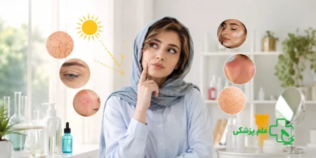 مراقبت از پوست در تابستان