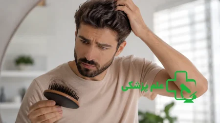 ریزش مو در تابستان